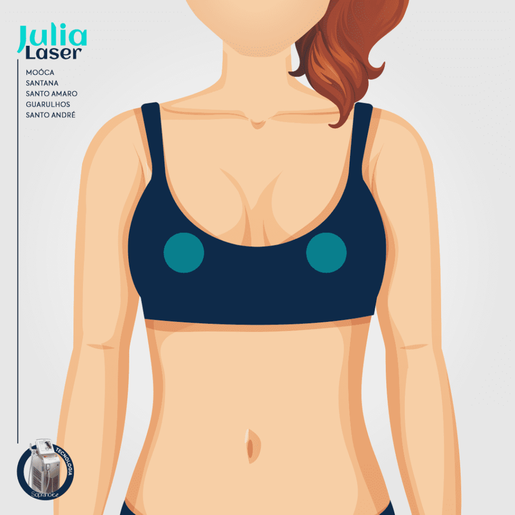 ARÉOLAS PACOTE 6 SESSÕES Julia Laser