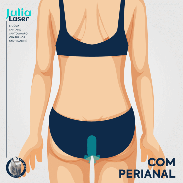 PACOTE 6 SESSÕES VIRILHA COMPLETA, SIMPLES OU CAVADA COM PERIANAL - Imagem 5