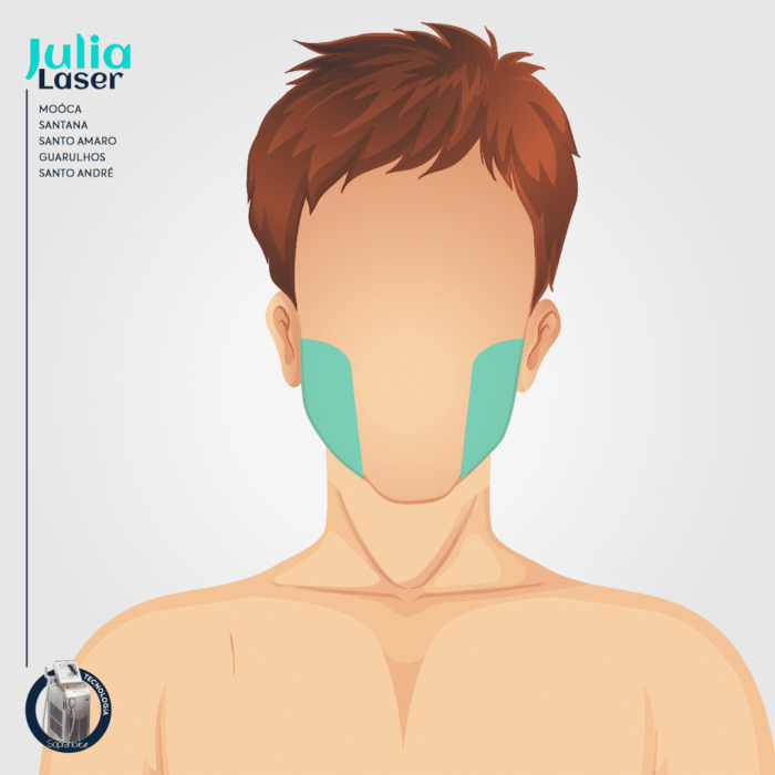 Pacote 10 Sessões Depilação Bochechas Masculinas - Image 2