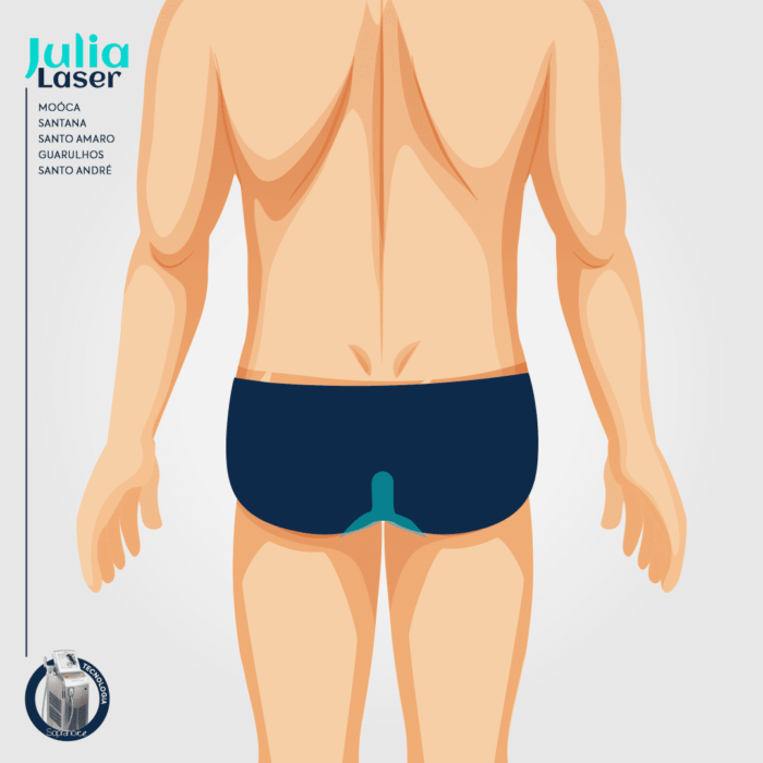 Pacote 10 Sessões Depilação Perianal Masculino - Image 2